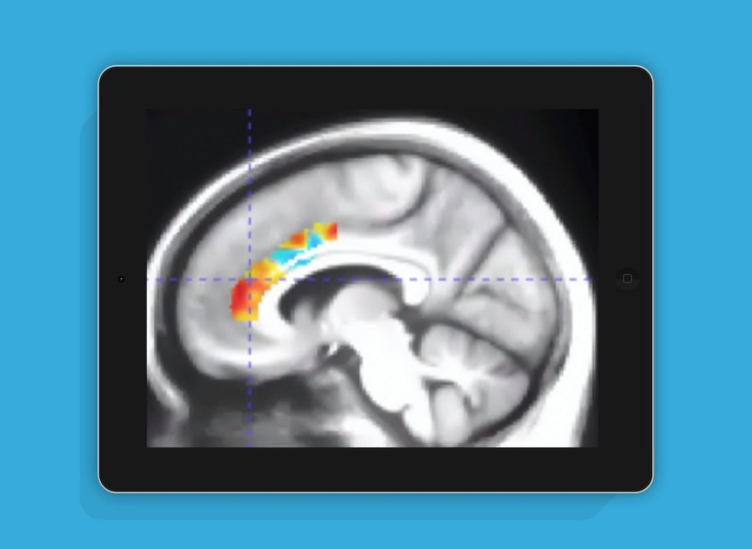 国外新研究 游玩10周大脑训练类游戏可抵消10年脑退化