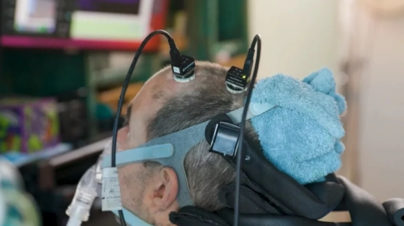 ALS-patiënt heeft al twee jaar een hersen-computerinterface geïmplanteerd en kan met zijn bewustzijn miljoenen woorden spreken